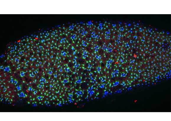 'De novo' Centrioles in Eggs