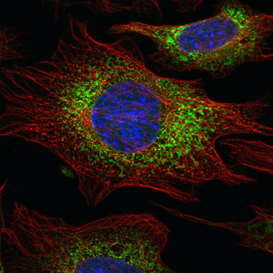 Mouse embryonic fibroblasts - Viorica Liebe (Freeman Lab)