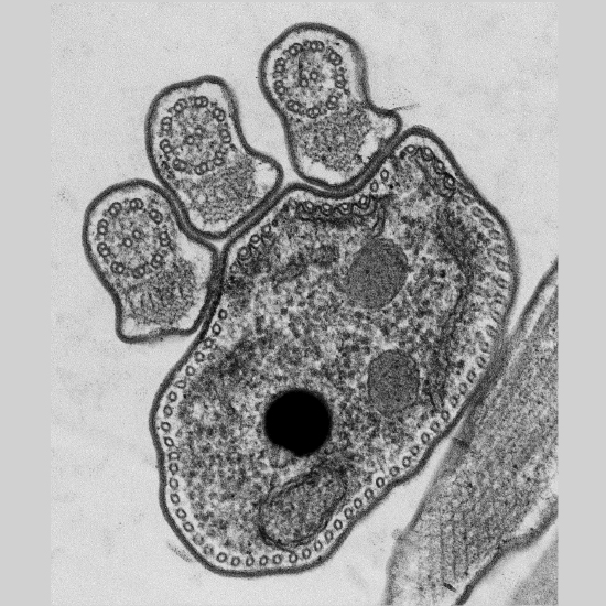 Trypanosoma brucei bloodstream form  - Jessica Valli (Gluenz Lab)