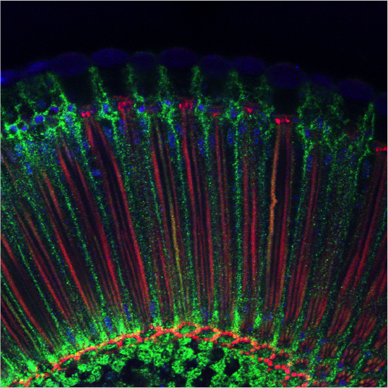 Drosophila adult retina  - Sonia Muliyil/Clemence Levet (Freeman Lab)